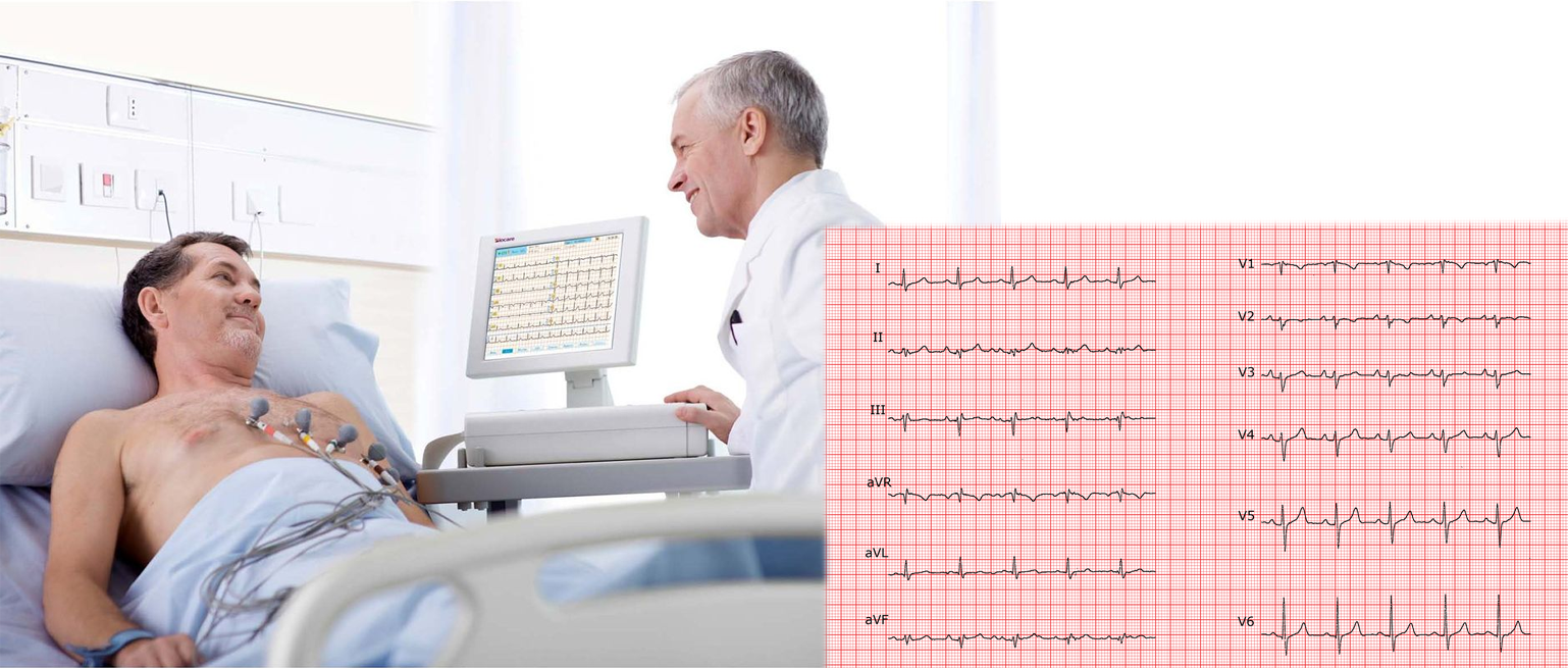 ECG
